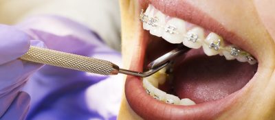 Dentures & Implants